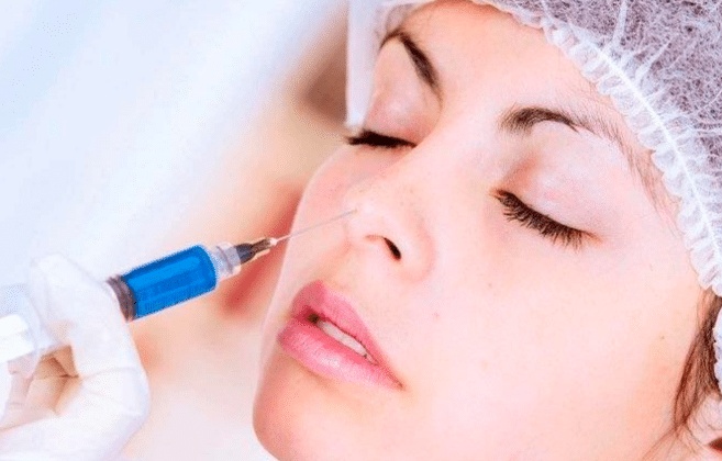 افضل دكتور تجميل انف بجده