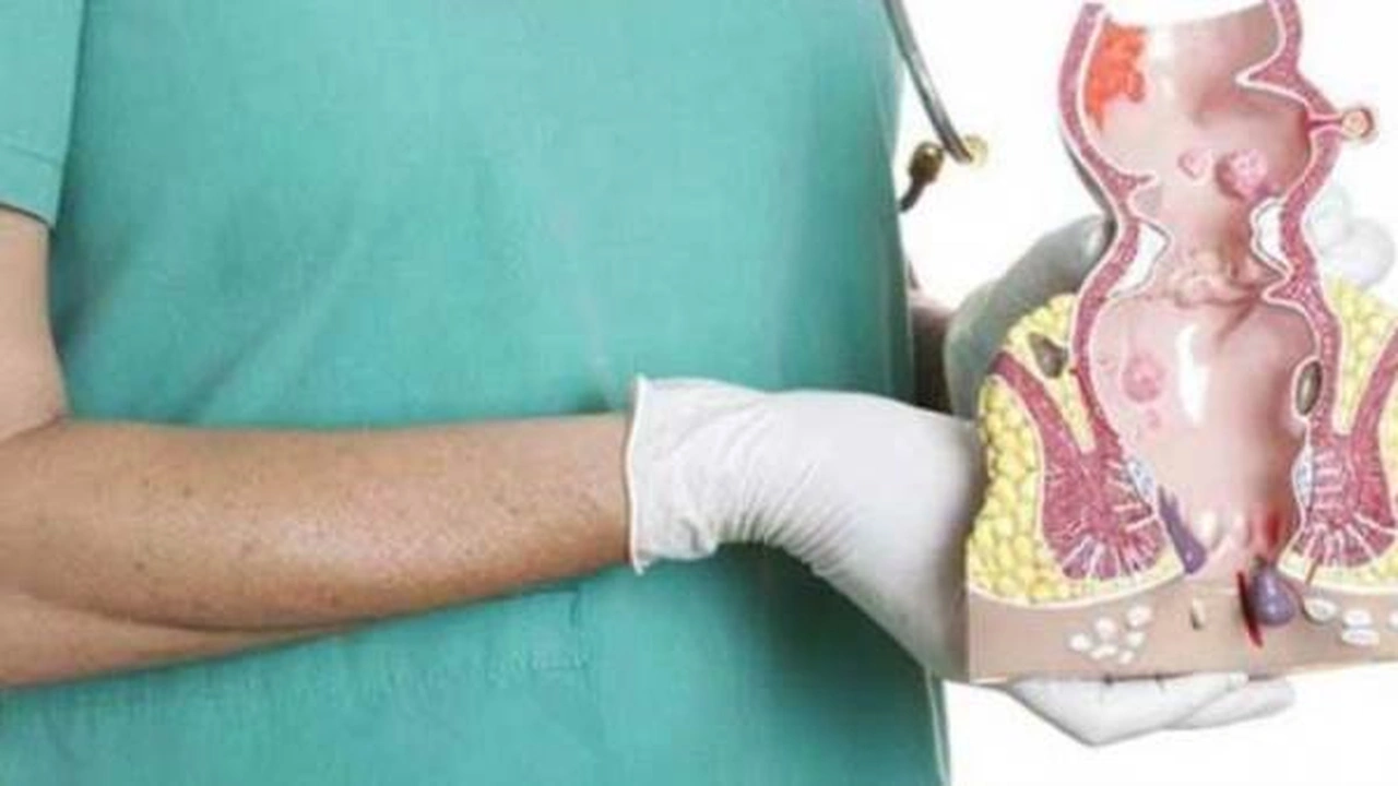 صورة افضل دكتور جراحة بواسير في الدمام