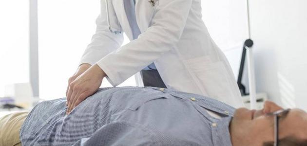 افضل دكتور جراحة فتق في جدة