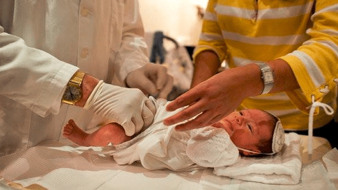 صورة افضل دكتور ختان في الرياض