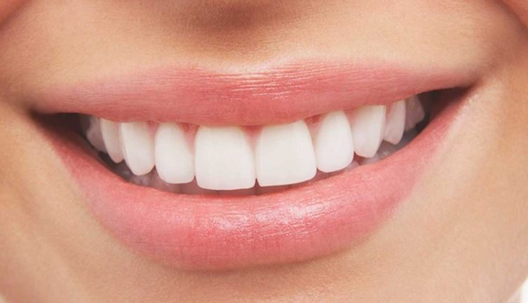 افضل دكتور زراعة اسنان في الطائف