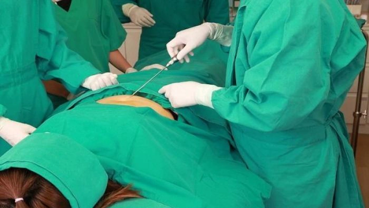 صورة افضل دكتور نحت الجسم في الكويت