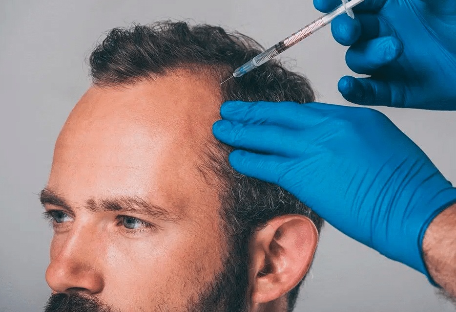 افضل عيادة لعلاج تساقط الشعر في مسقط