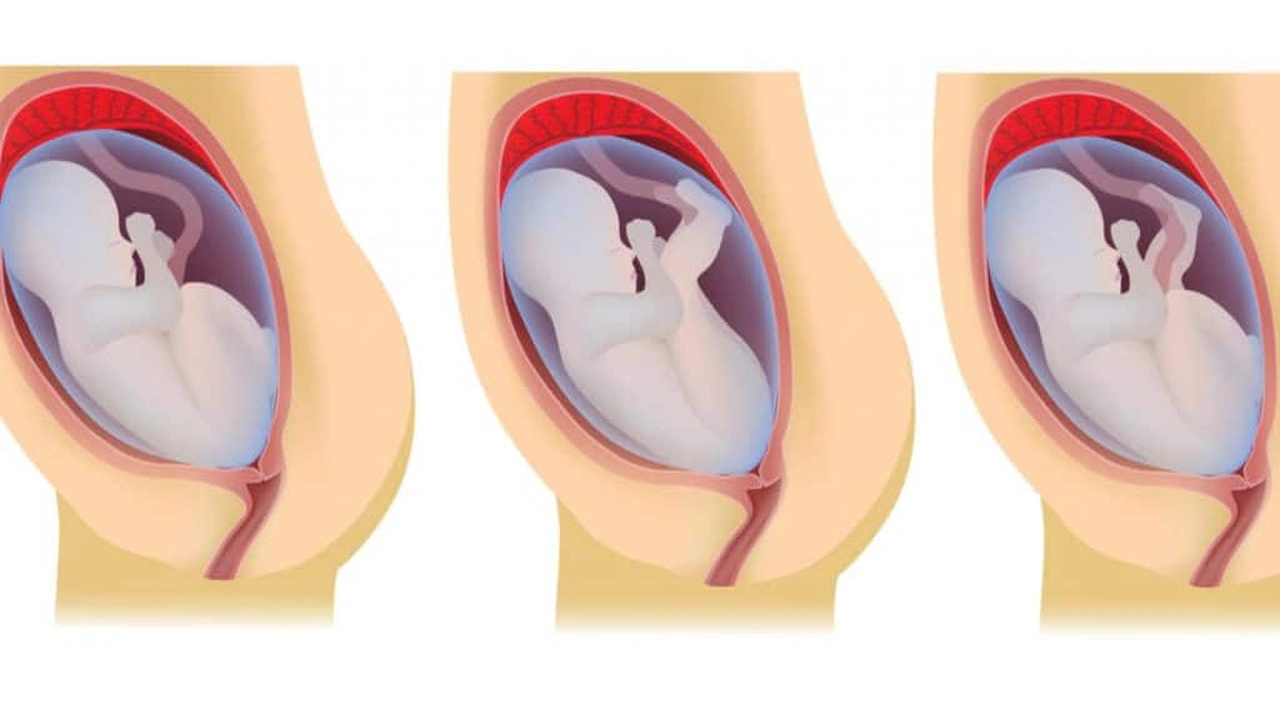 صورة تجاربكم مع الجنين المقعدي