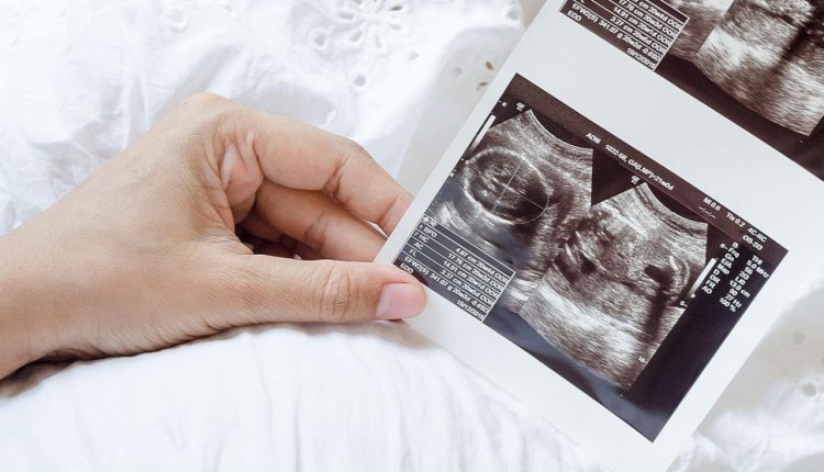 تجاربكم مع السونار وجنس الجنين