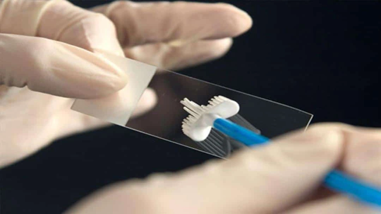 صورة تجاربكم مع خزعة الرحم