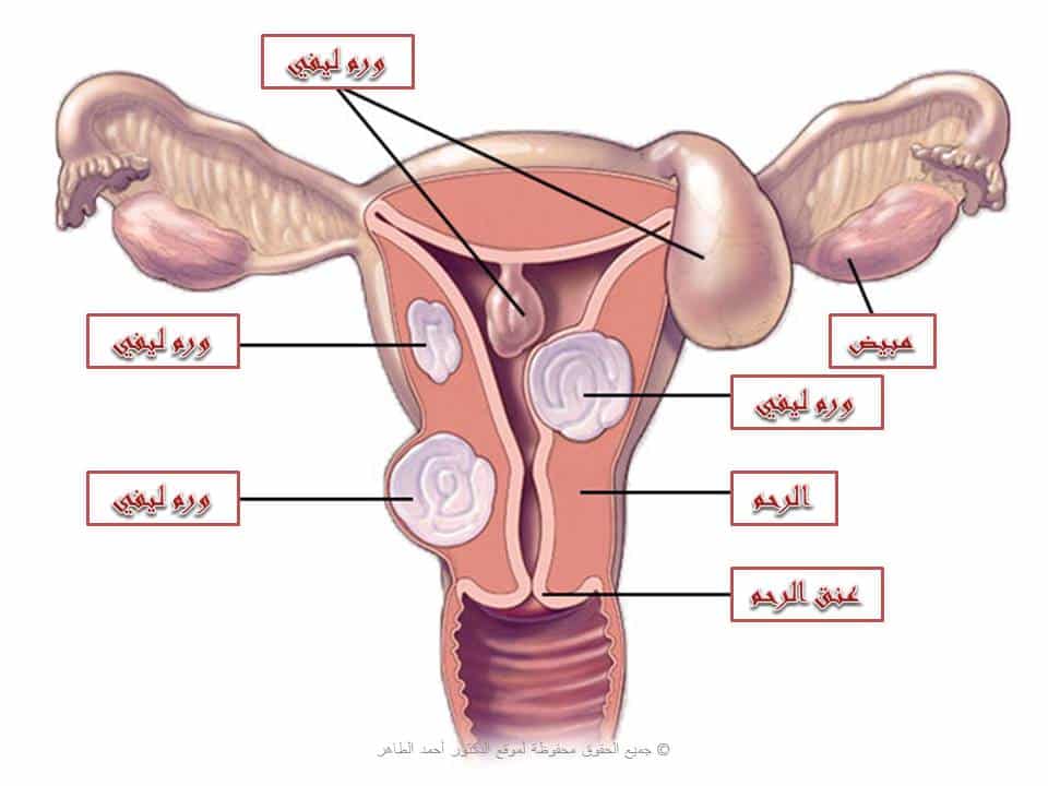 تجاربكم مع قسطرة الرحم