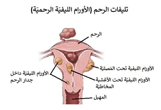 تجاربكم مع قسطرة الرحم