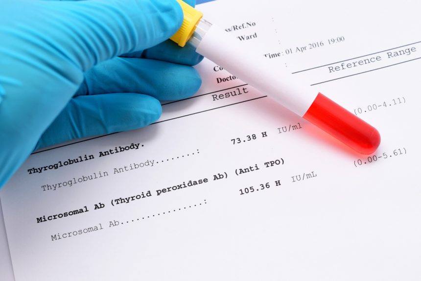 تجاربكم مع هرمون الحمل الرقمي