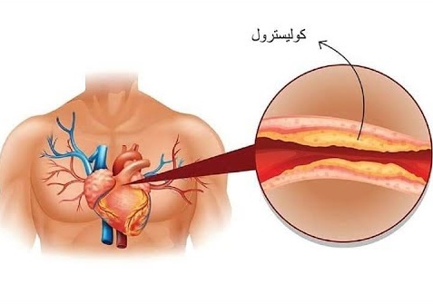 تجربتي في خفض الكوليسترول