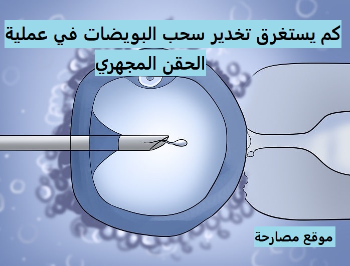 تجربتي في سحب البويضات