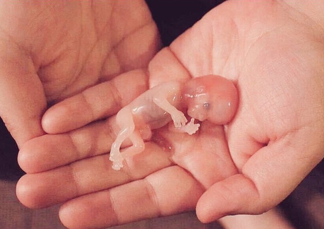 تجربتي مع الاجهاض في الشهر الثاني