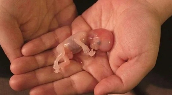 تجربتي مع الحمل بعد الاجهاض