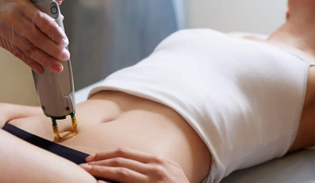 تجربتي مع الليزر وانا حامل