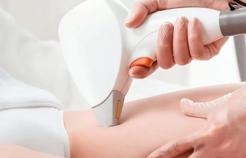 تجربتي مع الليزر وانا حامل