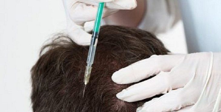 تجربتي مع الميزوثيرابي للشعر