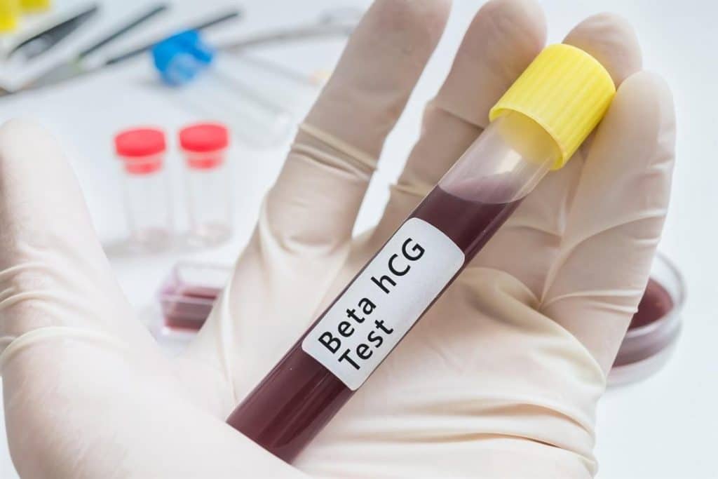 تجربتي مع انخفاض هرمون الحمل بعد الإجهاض