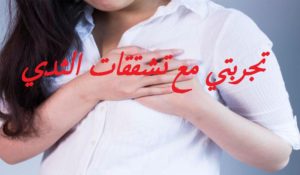 تجربتي مع تشققات الثدي