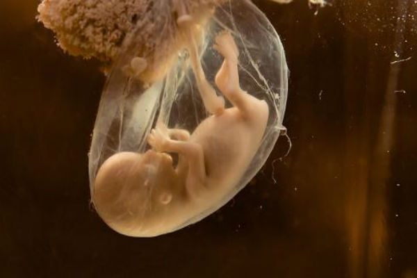 تجربتي مع ثقب كيس الجنين