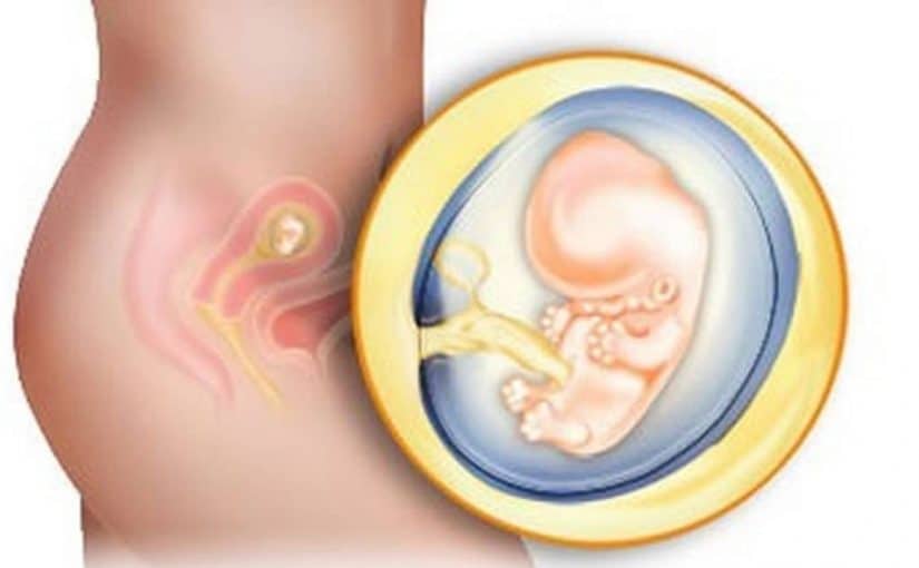تجربتي مع ثقب كيس الجنين