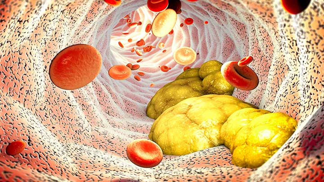 صورة تجربتي مع خفض الكولسترول