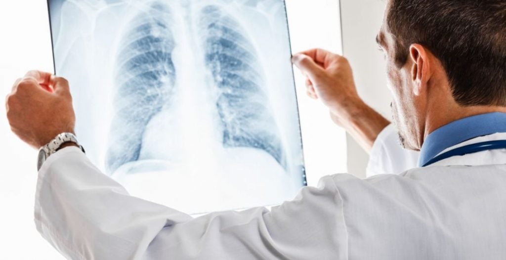 تجربتي مع زراعة الرئة