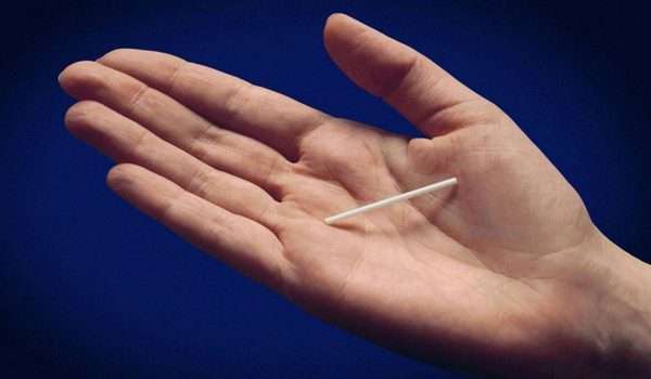 تجربتي مع شريحة منع الحمل