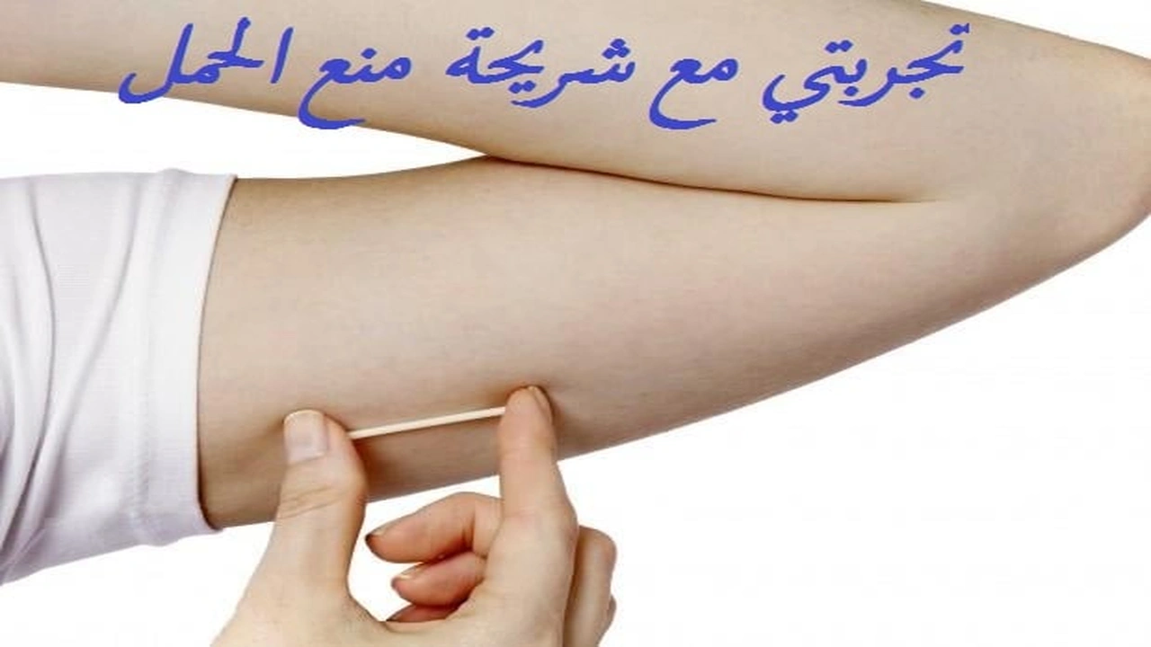 صورة تجربتي مع شريحة منع الحمل