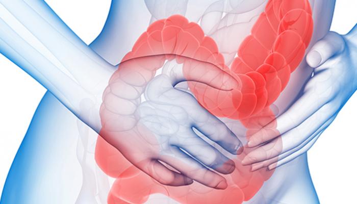 تجربتي مع علاج القولون