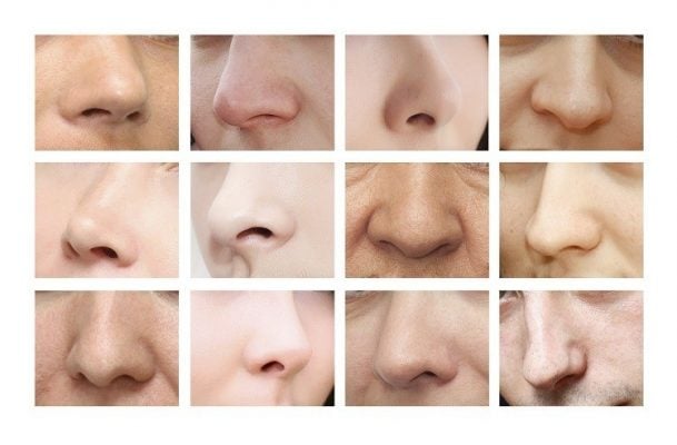 تجربتي مع عملية تجميل الاذن