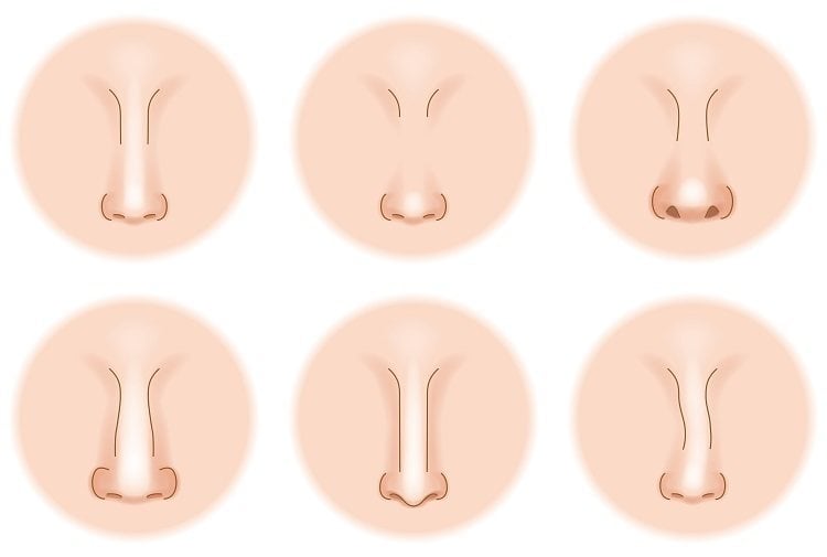 تجربتي مع عملية تجميل الانف