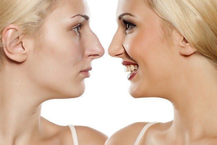 تجربتي مع عملية تجميل الانف