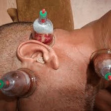 تجربتي مع مرض منيير