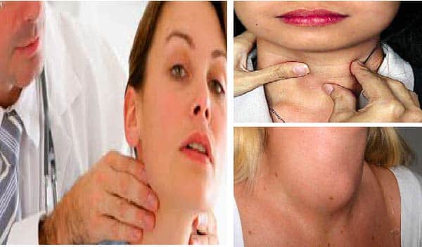 تجربتي مع مكمل اليود