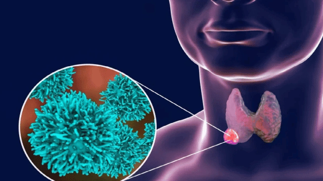 صورة تجربتي مع مكمل اليود
