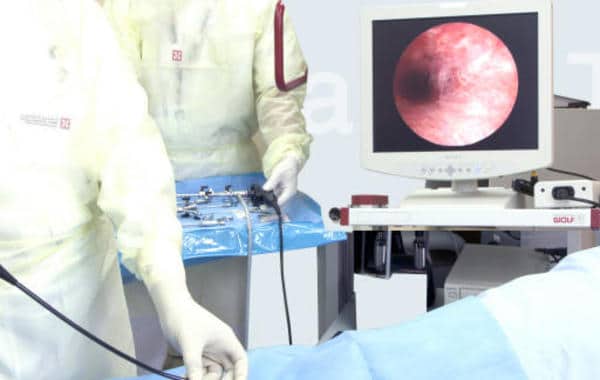 تجربتي مع منظار الحالب