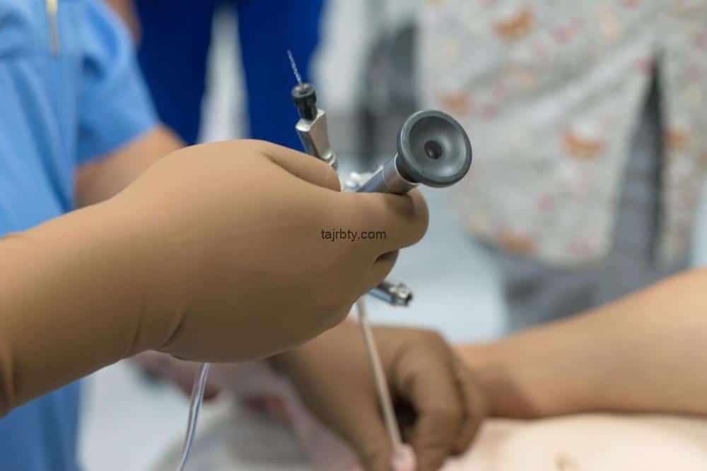 تجربتي مع منظار المثانة