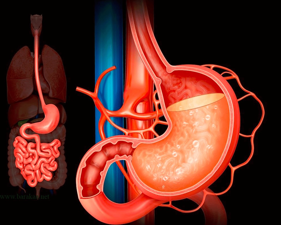 تجربتي مع نقص حمض المعدة