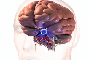 تجربتي مع ورم الغدة النخامية