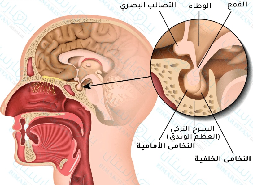 تجربتي مع ورم الغدة النخامية