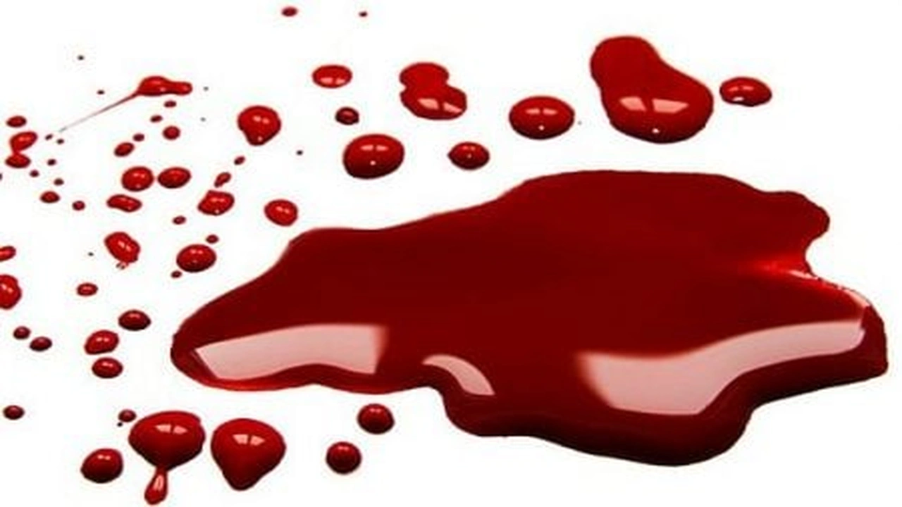 صورة تفسير حلم الدم في المنام