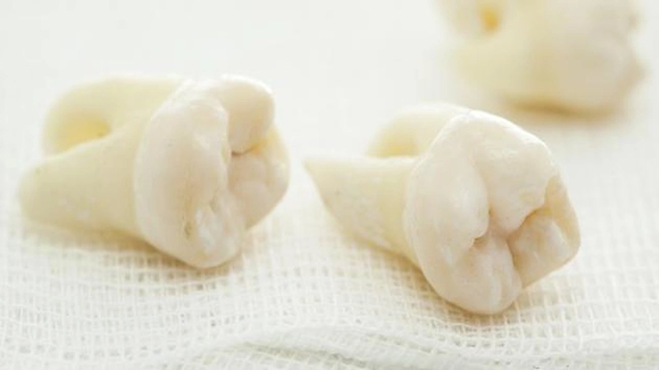 صورة تفسير حلم وقوع الاسنان