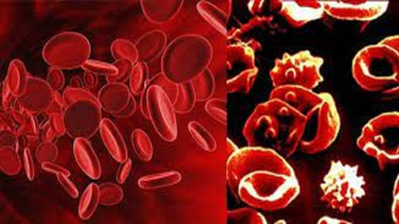 صورة تقرير عن الثلاسيميا