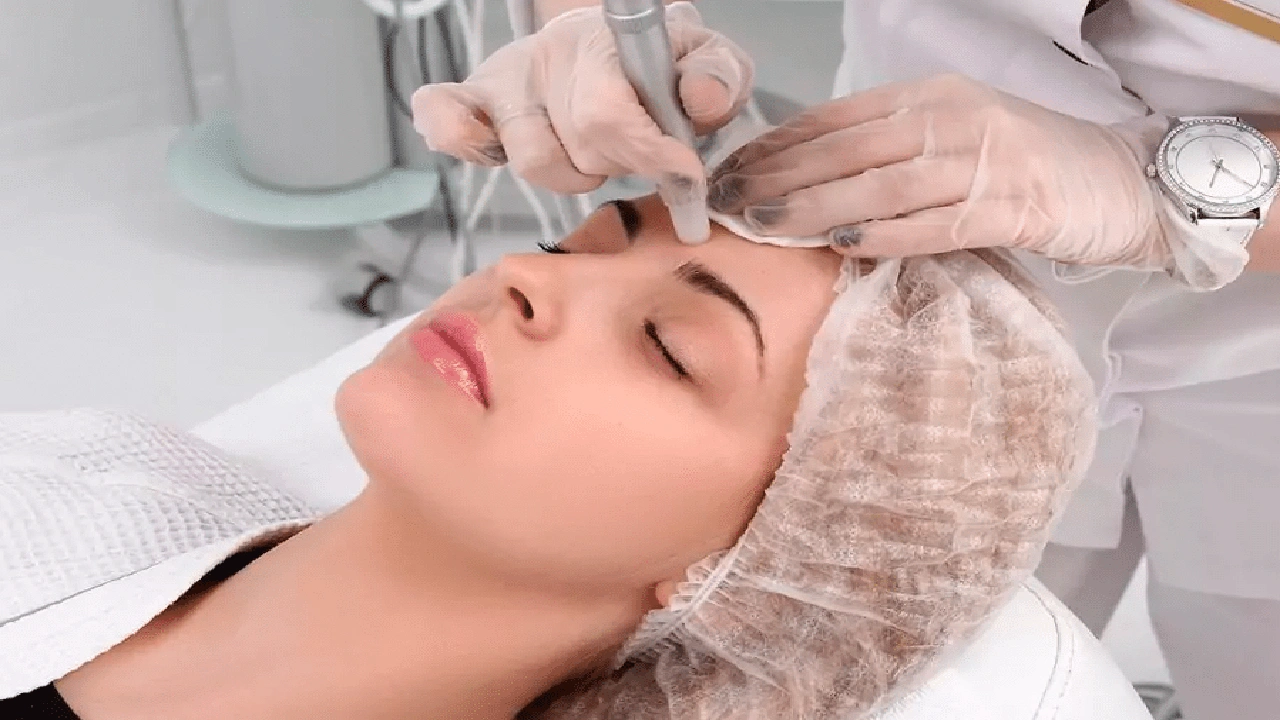 صورة خطوات ليزر الوجه