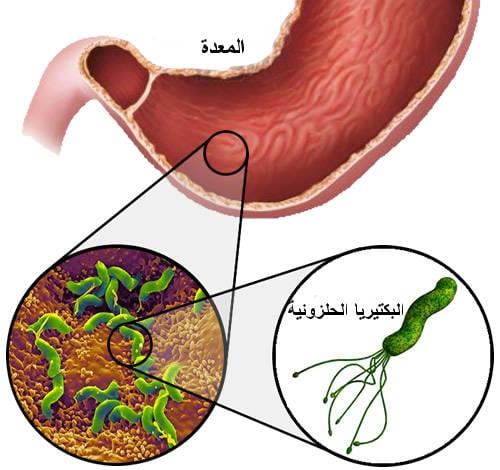دعاء الشفاء من جرثومه المعده