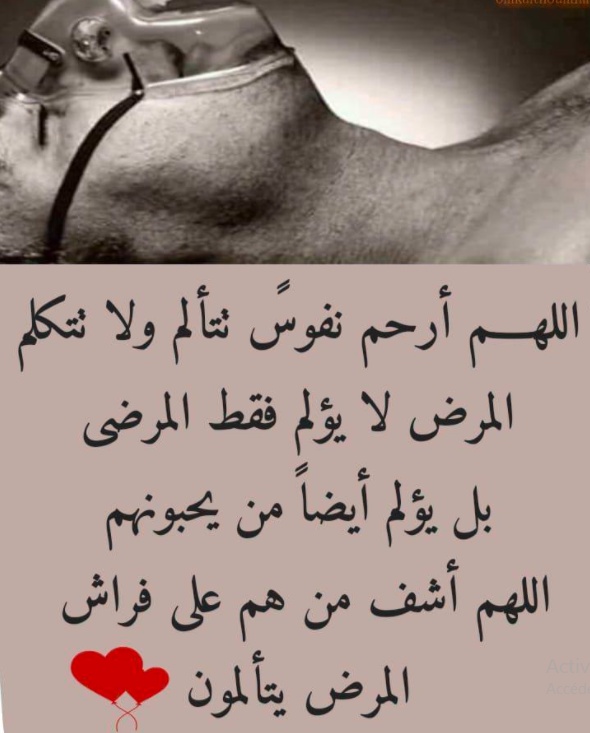 دعاء لشفاء الحروق