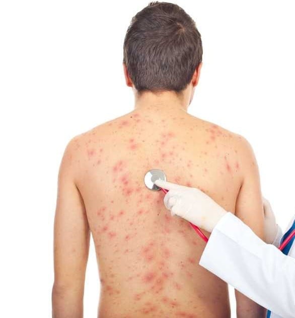 دعاء لشفاء الحساسية