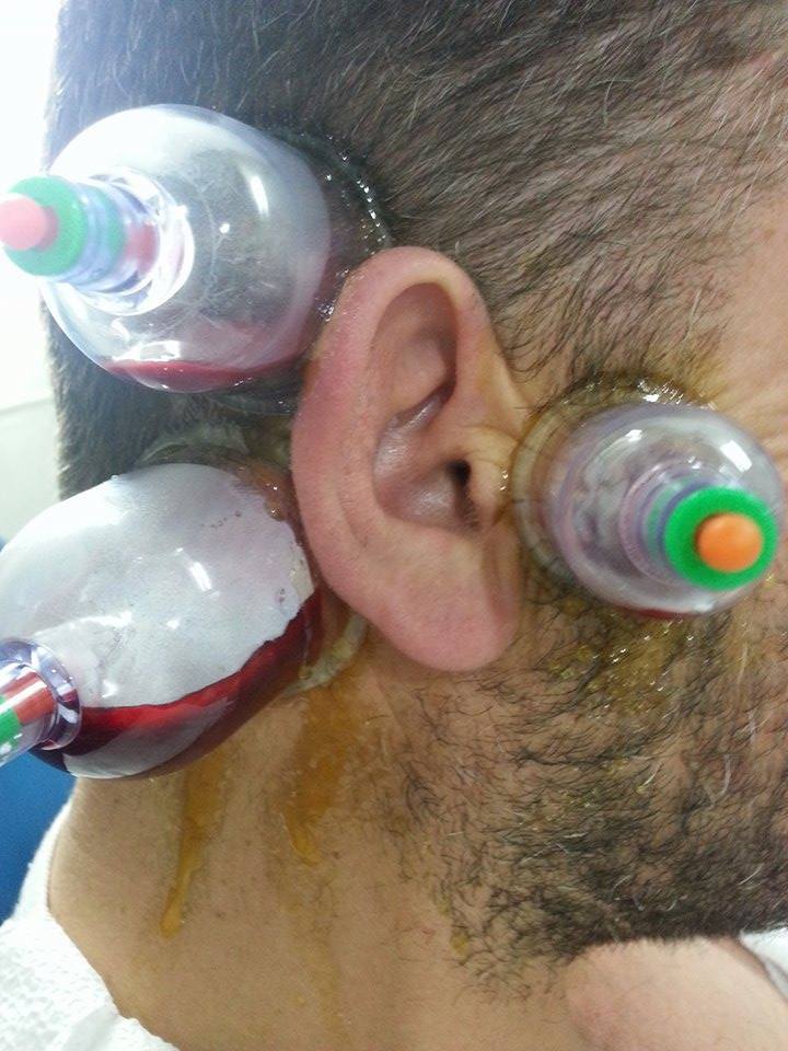 دعاء لشفاء السمع بالقرآن