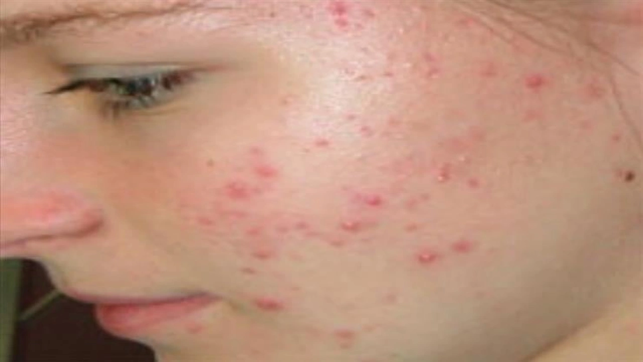 صورة دعاء لشفاء الوجه من حب الشباب