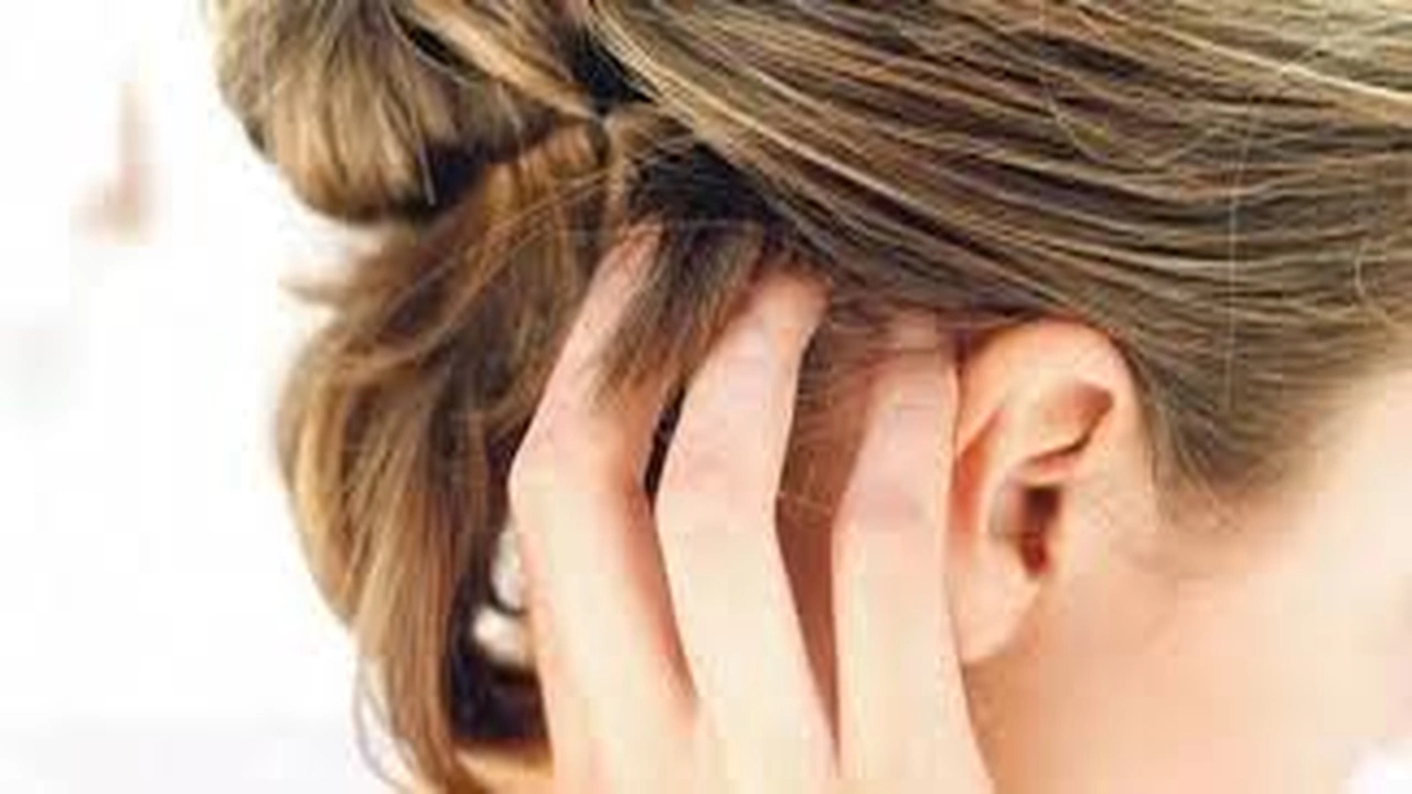 صورة سبب و علاج حكة فروة الراس وتساقط الشعر